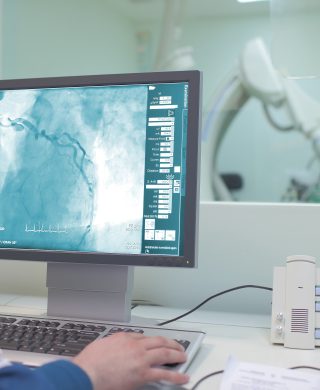 Visualization of the heart vessels (coronary vessels), on a medical monitor, used to explain coronary computed tomography angiography