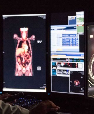CT scan images which can be used to help detect cancer